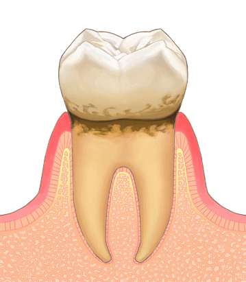 八王子駅南口・八王子駅前リーフ歯科