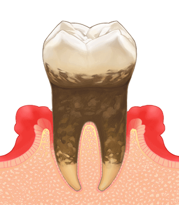 八王子駅南口・八王子駅前リーフ歯科