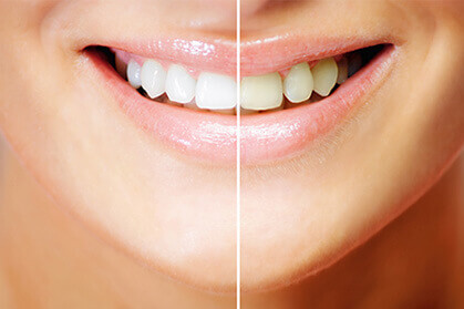 八王子駅南口・八王子駅前リーフ歯科